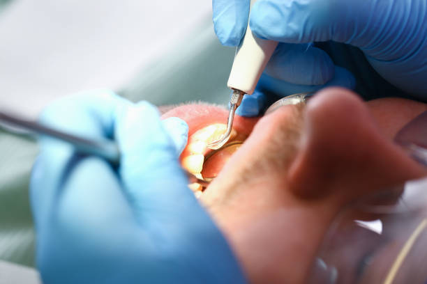 Best Emergency Treatment for Toothache in Bayview, CA