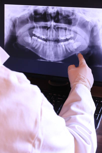 Best Walk-In Emergency Dentist in Bayview, CA