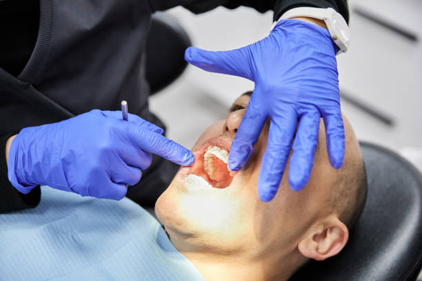 Best Emergency Tooth Extraction in Bayview, CA